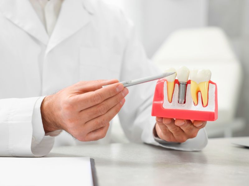 implante dentário brasília